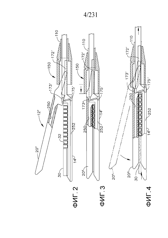 Компенсаторы толщины ткани (патент 2627626)