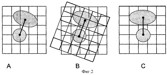 Способ визуализации позвоночника методом магнитно-резонансной томографии (патент 2368313)