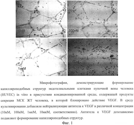 Средство для лечения ожогов и ран на основе цитокинов и факторов роста, секретируемых мезенхимными клетками человека, способ получения средства и способ лечения ожогов и ран (патент 2574017)