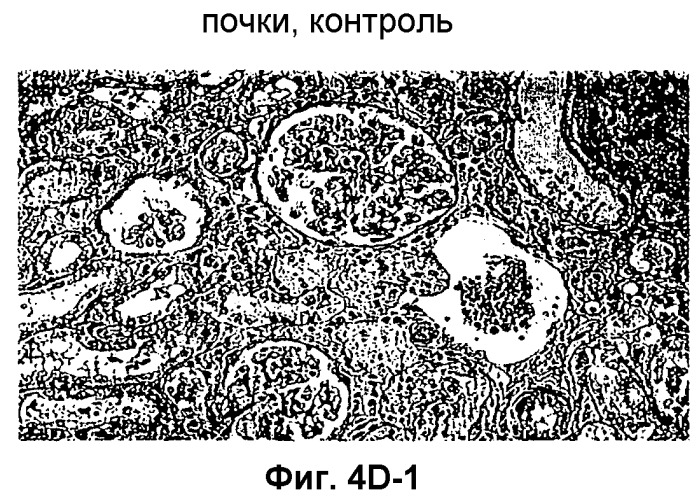 Способ получения индуцирующих воспринимаемость трансплантата клеток моноцитарного происхождения, способ получения фармацевтической композиции для подавления реакций отторжения трансплантата, индуцирующие воспринимаемость трансплантата клетки моноцитарного происхождения, клеточный препарат для индукции воспринимаемости трансплантата, фармацевтическая композиция для подавления реакций отторжения трансплантата, применение индуцирующих воспринимаемость трансплантата клеток (варианты), способ получения и/или размножения регуляторных т-лимфоцитов, гибридомная клеточная линия, антитело и применение антитела (патент 2370535)