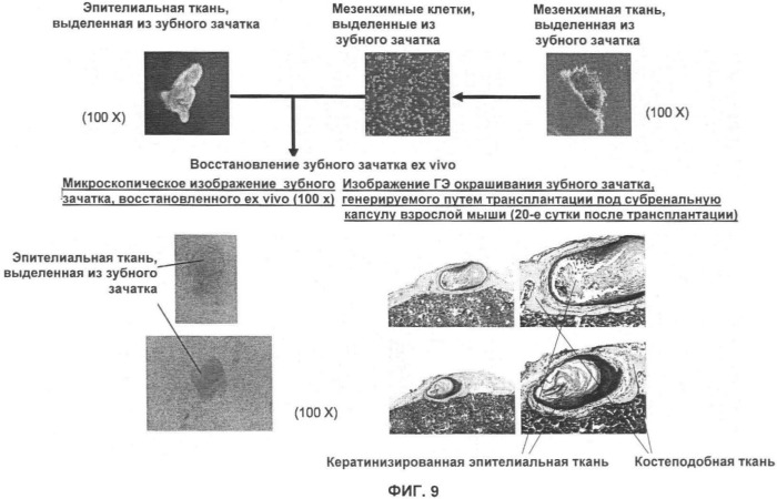 Способ формирования зуба, зубной ряд и способ формирования ткани (патент 2428140)