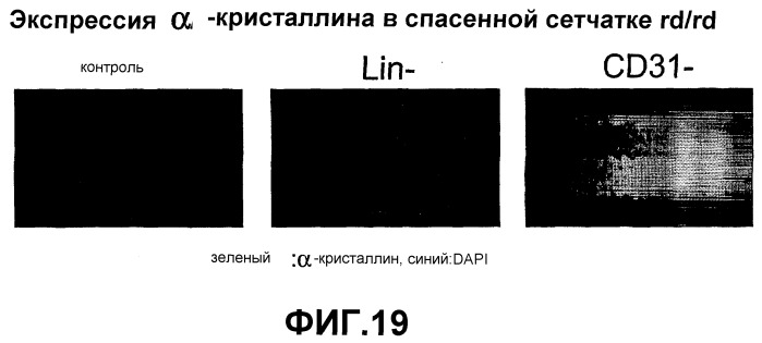 Гематопоэтические стволовые клетки и способы лечения неоваскулярных заболеваний глаз с их помощью (патент 2389497)