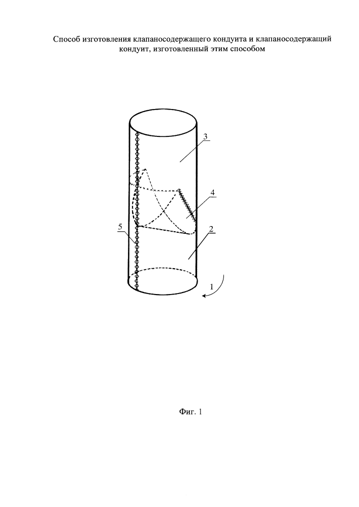 Способ изготовления клапаносодержащего кондуита и клапаносодержащий кондуит, изготовленный этим способом (патент 2644287)