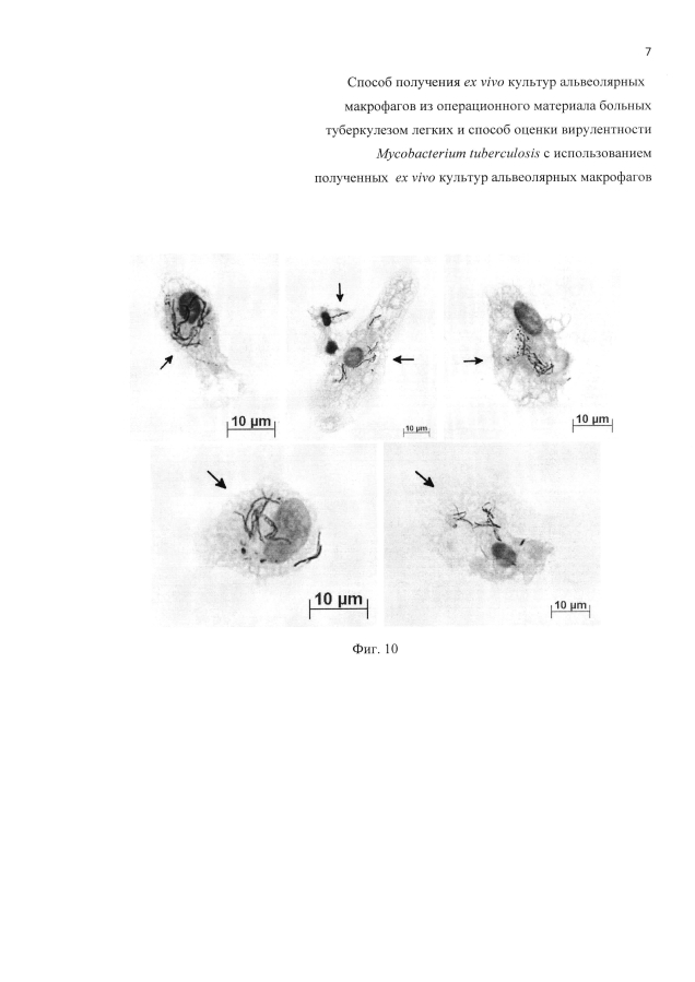 Способ получения ex vivo культур альвеолярных макрофагов из операционного материала больных туберкулезом легких и способ оценки вирулентности mycobacterium tuberculosis с использованием полученных ex vivo культур альвеолярных макрофагов (патент 2593725)