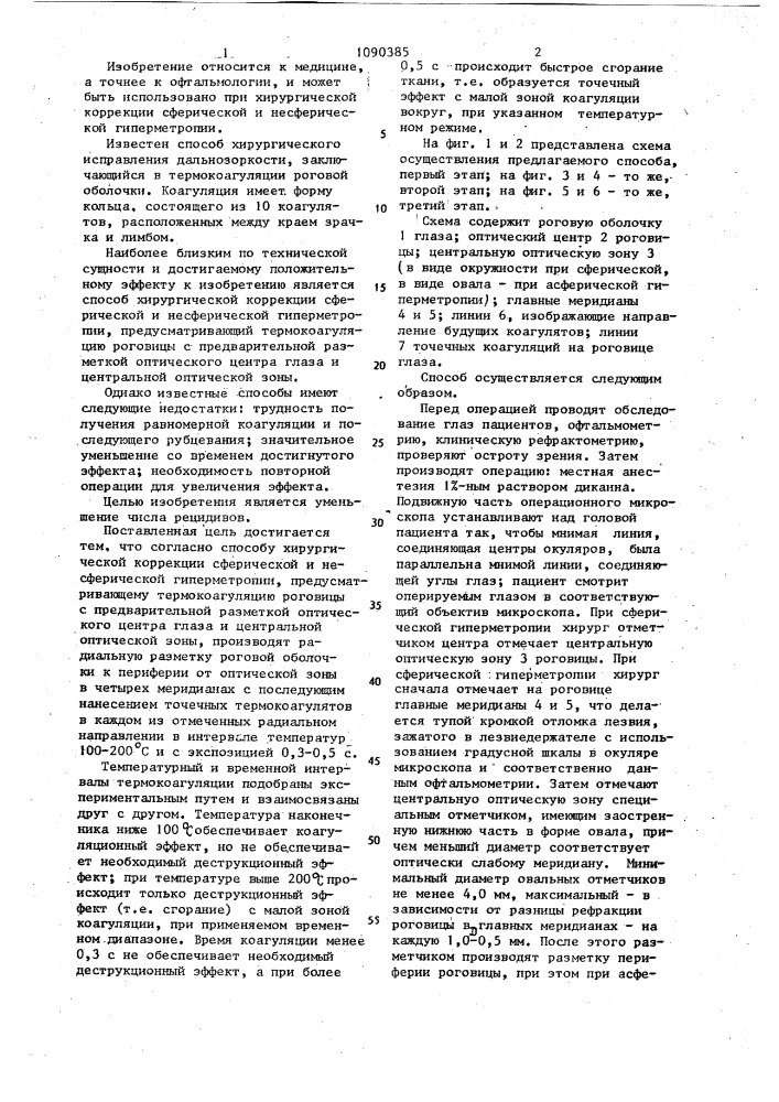 Способ хирургической коррекции сферической и несферической гиперметропии (патент 1090385)