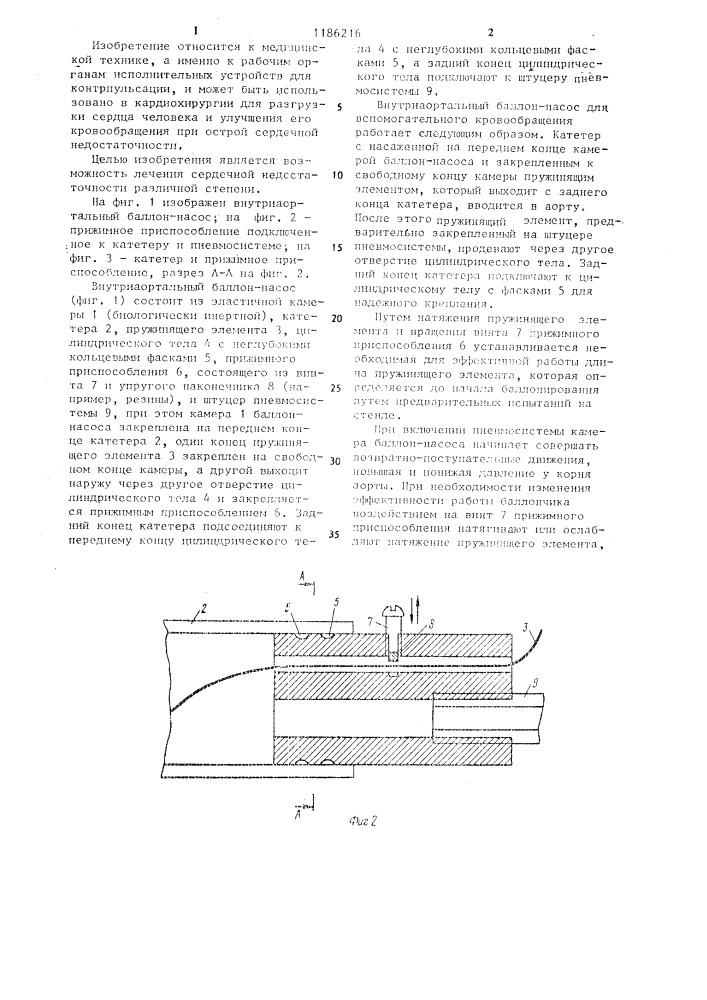 Внутриаортальный баллон-насос для вспомогательного кровообращения (патент 1186216)