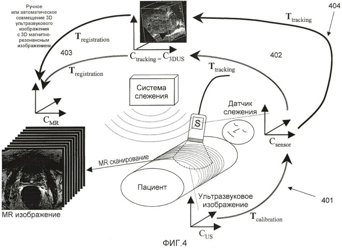 Система и способ для объединения ультразвуковых изображений в реальном времени с ранее полученными медицинскими изображениями (патент 2468436)