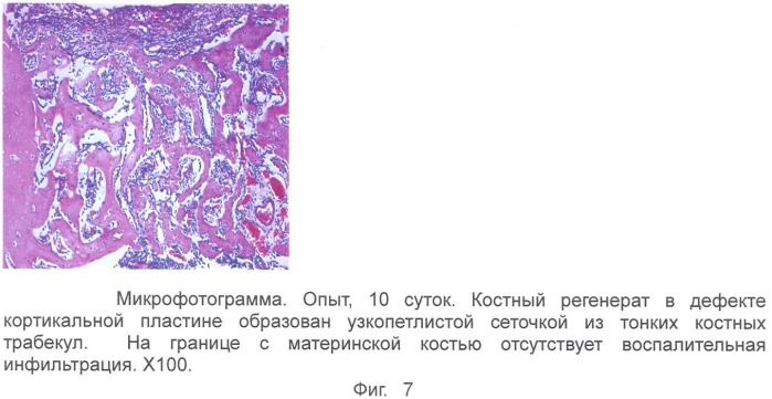 Гель для регенерации костной ткани (патент 2360663)