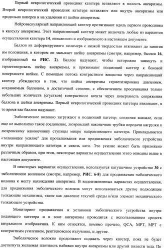 Эмболический протез для лечения васкулярной аневризмы (патент 2407464)