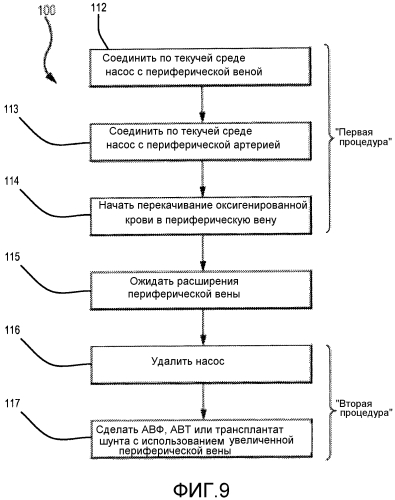 Система и способ увеличения наружного диаметра вен (патент 2574711)