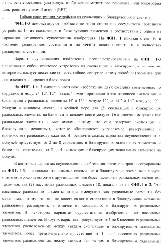 Стент из скользящих и блокирующих элементов (патент 2429801)