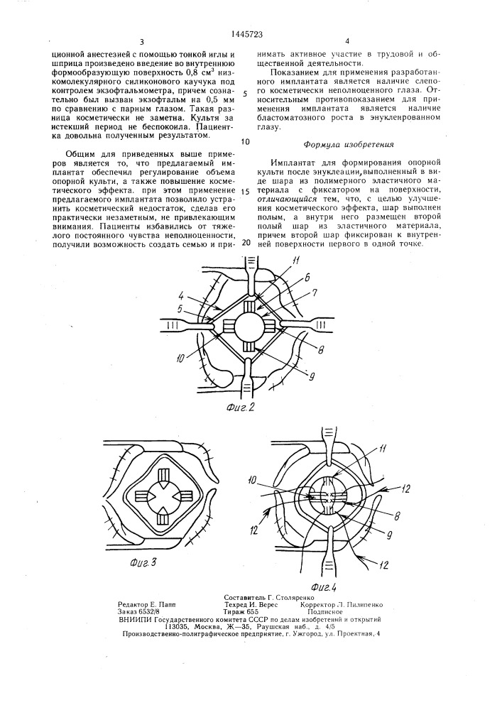Имплантат для формирования опорной культи после энуклеации (патент 1445723)