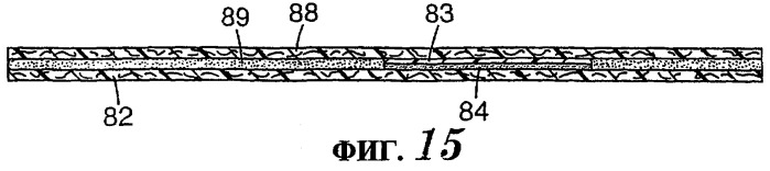 Сложное застежечное приспособление для изделий одноразового использования (патент 2318483)