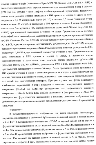 Способ получения фактора, связанного с контролем над потреблением пищи и/или массой тела, полипептид, обладающий активностью подавления потребления пищи и/или прибавления в весе, молекула нуклеиновой кислоты, кодирующая полипептид, способы и применение полипептида (патент 2418002)