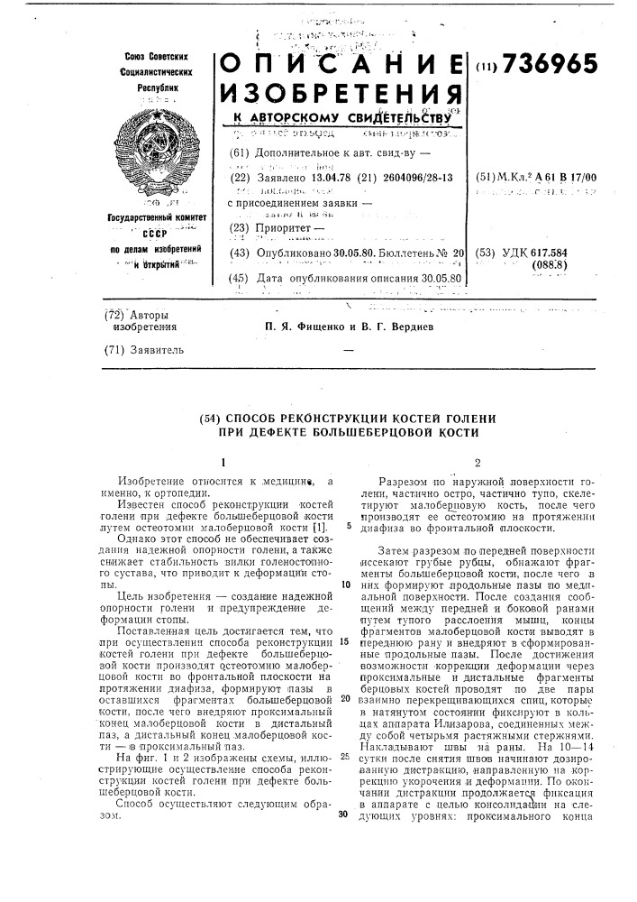 Способ реконструкции костей голени при дефекте большеберцовой кости (патент 736965)