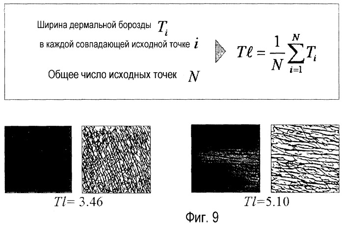 Способ автоматической оценки текстуры кожи и/или морщины (патент 2470576)