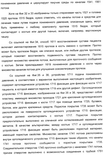 Система и способ продувки устройства пониженного давления во время лечения путем подачи пониженного давления (патент 2404822)