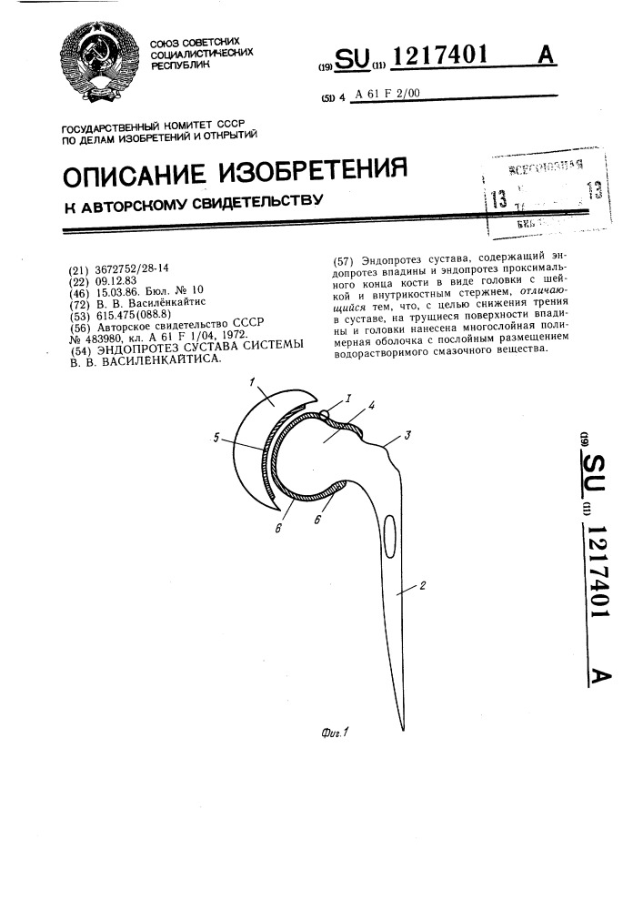Эндопротез сустава системы в.в.василенкайтиса (патент 1217401)