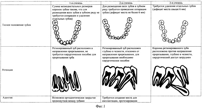 Способ выбора тактики ортодонтического лечения (патент 2447838)