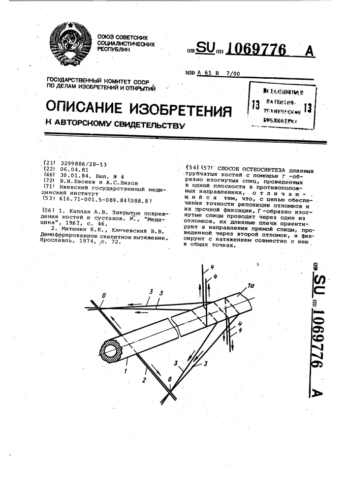 Способ остеосинтеза (патент 1069776)