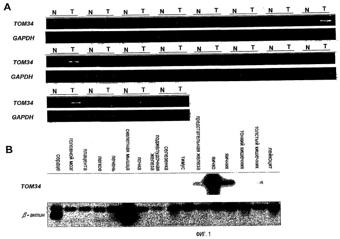 Связанный с раком толстого кишечника ген том34 (патент 2449020)
