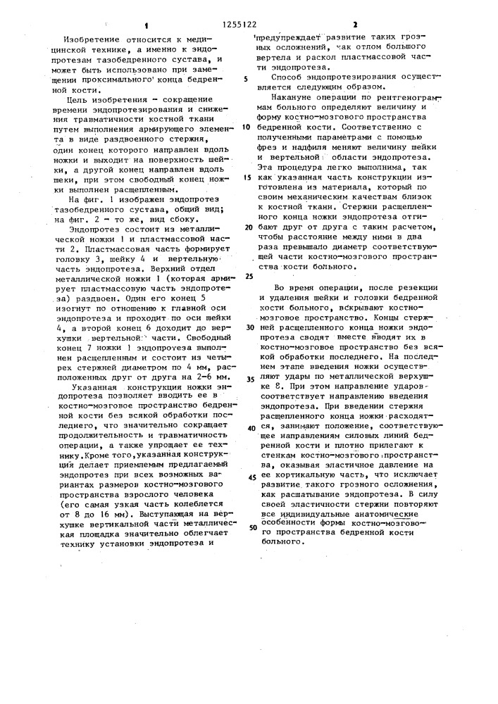 Эндопротез тазобедренного сустава (патент 1255122)
