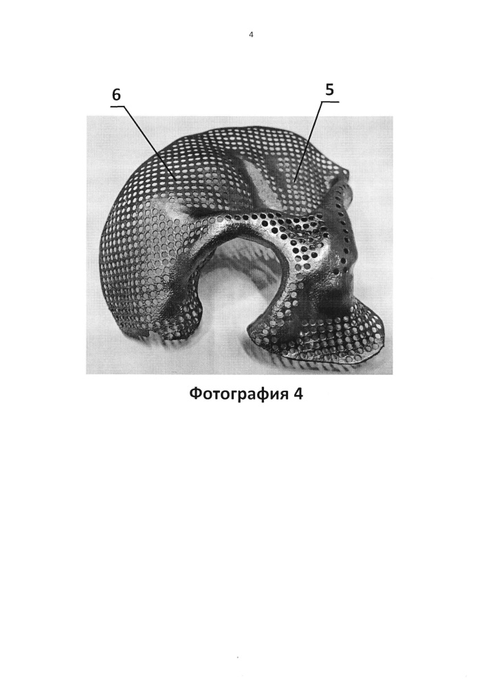 Имплантат для протезирования костей черепа и способ изготовления имплантата для протезирования костей черепа (патент 2638894)