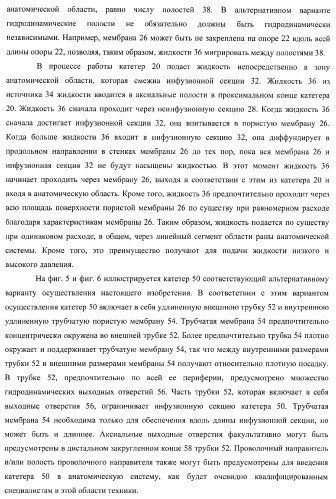 Катетер для равномерной подачи лекарственного средства (патент 2366465)