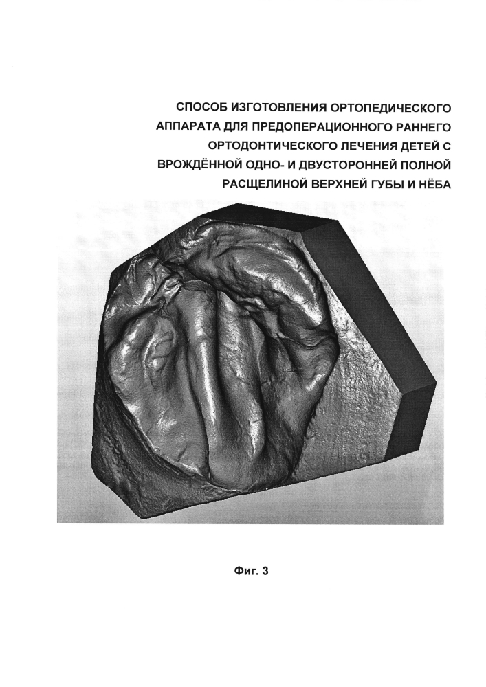 Способ изготовления ортопедического аппарата для предоперационного раннего ортодонтического лечения детей с врождённой одно- и двусторонней полной расщелиной верхней губы и нёба (патент 2599373)