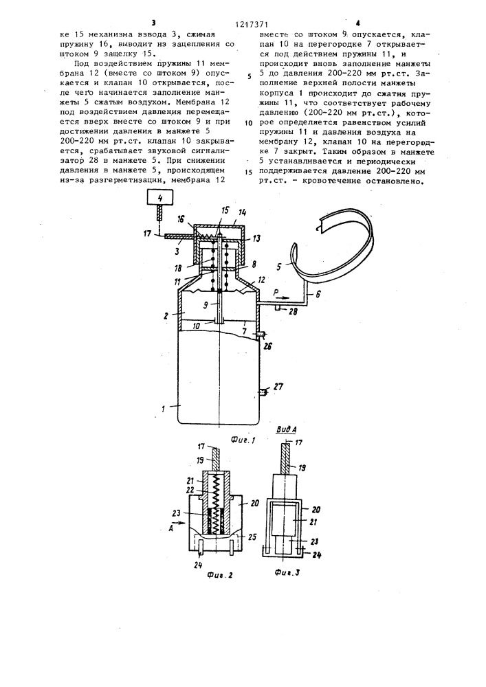 Устройство для остановки кровотечения (патент 1217371)