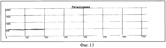 Способ определения типа демпинг-реакции при демпинг-синдроме (патент 2334456)