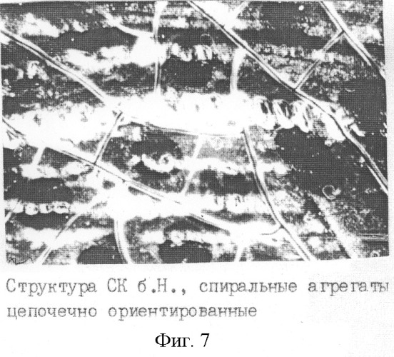 Способ экспресс-диагностики гипер-бета 2-микроглобулинемии (патент 2259565)