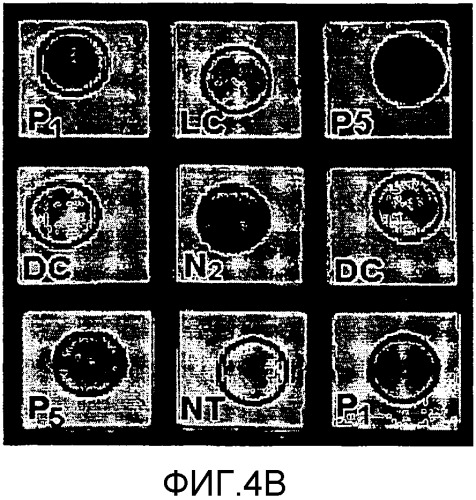 Сенсибилизированный оперативный bold-mri способ получения изображения (патент 2343829)