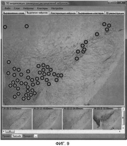 Автоматизированная система реконструкции 3d распределения нейронов по серии изображений срезов головного мозга (патент 2504012)