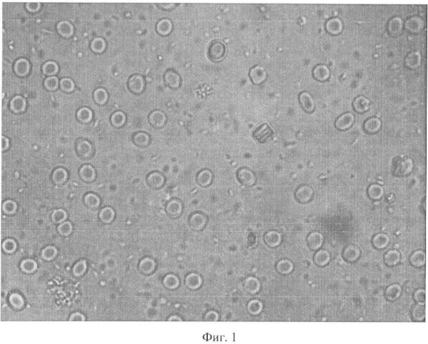 Способ определения степени агрегации клеток крови (патент 2484465)