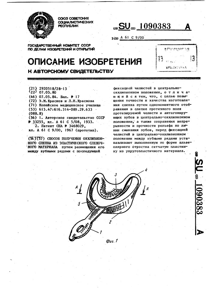 Способ получения окклюзионного слепка из эластического слепочного материала (патент 1090383)