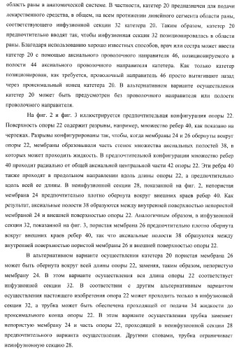 Катетер для равномерной подачи лекарственного средства (патент 2366465)