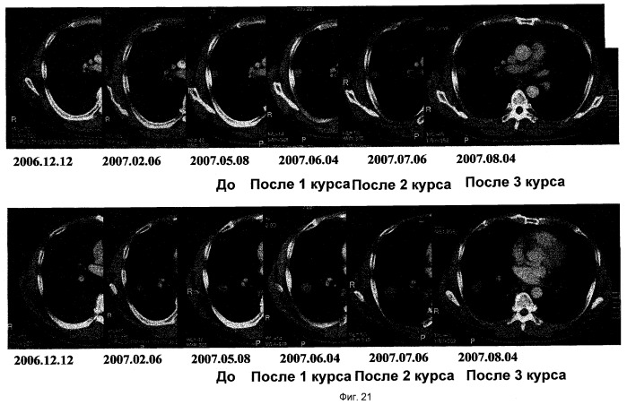 Пептидные вакцины против рака с экспрессией полипептидов mphosph1 или depdc1 (патент 2469044)