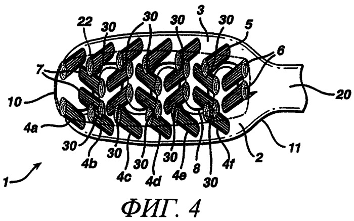 Зубная щетка и головка зубной щетки (патент 2287972)
