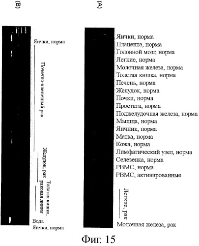 Идентификация опухолевых антигенов для диагностики и терапии (патент 2485974)
