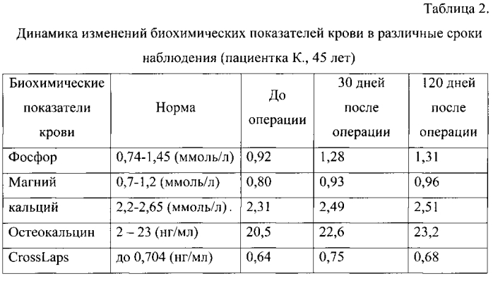 Способ лечения замедленной консолидации, несрастающихся переломов трубчатых костей (патент 2572004)