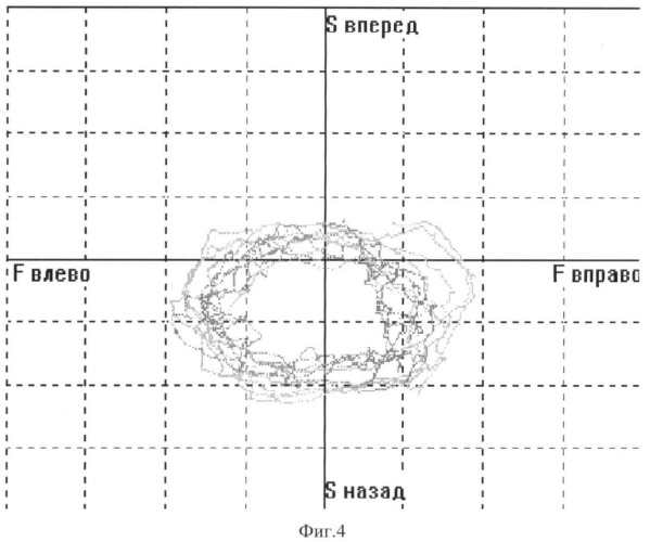 Способ формирования устойчивости вертикальной позы у пациентов со статодинамическими нарушениями (патент 2448645)