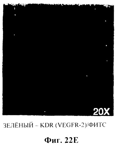 Захват эндотелиальных клеток-предшественников элюирующим лекарственные средства имплантируемым медицинским устройством (патент 2400256)