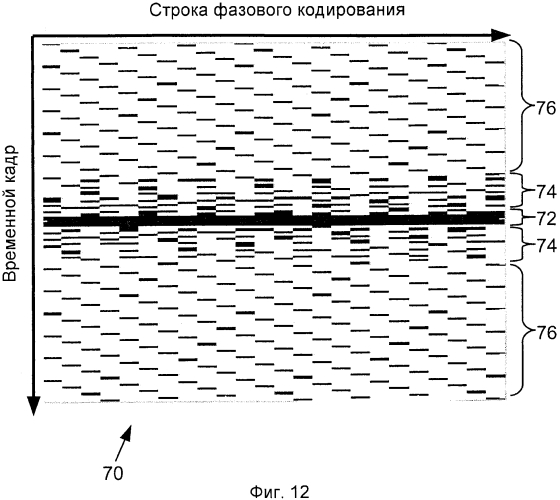 Быстрая параллельная реконструкция для произвольных траекторий к-пространства (патент 2575135)