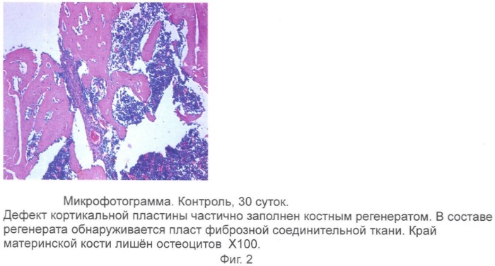 Гель для регенерации костной ткани (патент 2360663)