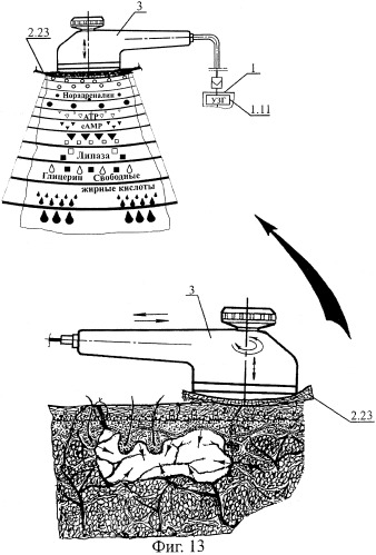 Способ липосакции и устройство для его осуществления (патент 2297849)