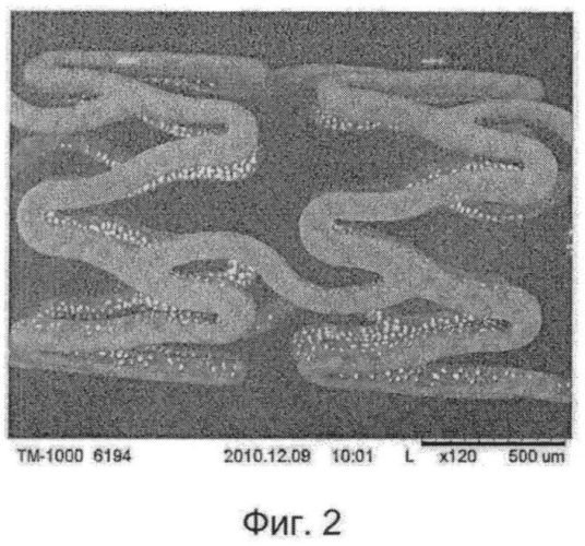 Имплантируемый стент (патент 2571685)