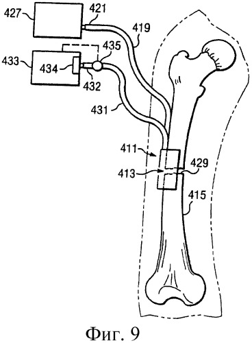 Устройство для лечения путем подкожной подачи пониженного давления с использованием текучей магистрали и связанный с ним способ (патент 2405459)