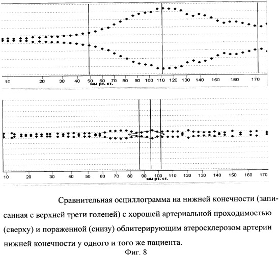 Способ определения артериального давления, параметров гемодинамики и состояния сосудистой стенки с использованием осциллометрии высокого разрешения (патент 2360596)