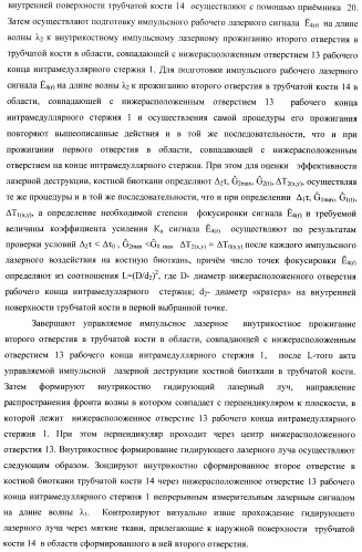 Способ дистального блокирования интрамедуллярных стержней при остеосинтезе длинных трубчатых костей и устройство для его осуществления (патент 2387401)